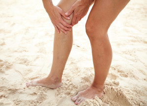 Woman legs pain with cramp on the beach.